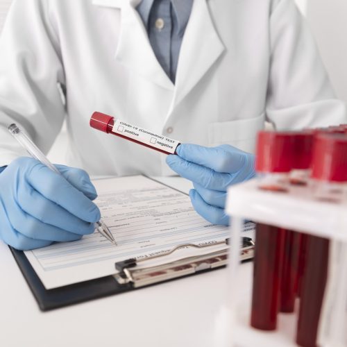 coronavirus-blood-samples-assortment-lab